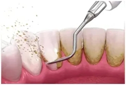 640 (3)_副本 640 (3)_副本