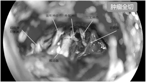 640 (4)_副本 640 (4)_副本