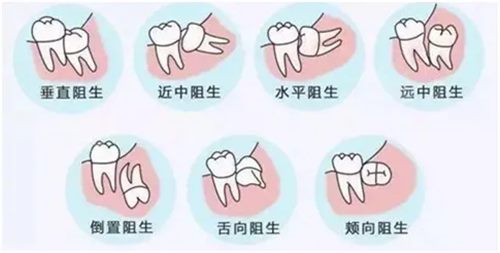 640 (1)_副本 640 (1)_副本