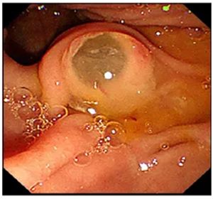 640 (1)_副本 640 (1)_副本