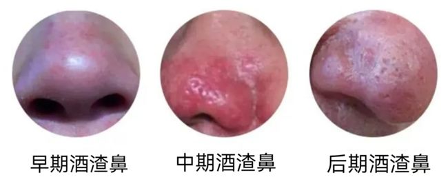 640_副本 640_副本