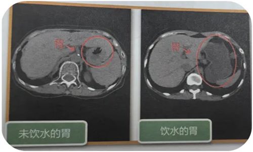 640 (1)_副本 640 (1)_副本