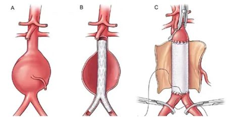 640 (3)_副本 640 (3)_副本
