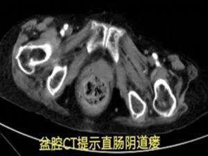 640 (8)_副本 640 (8)_副本